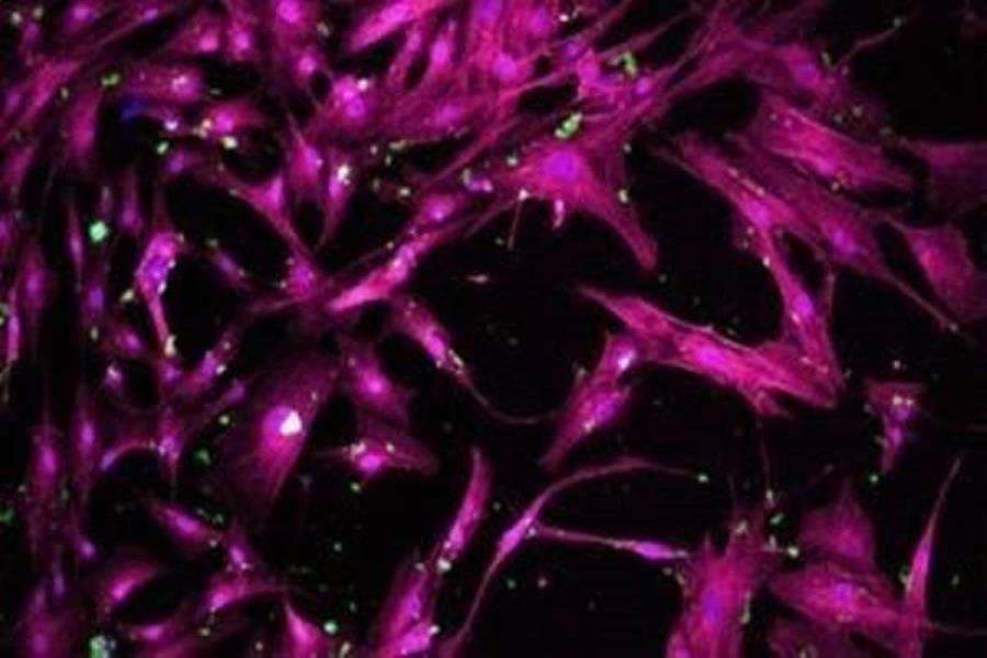 استفاده از نانوذرات جهت هدایت تمایز سلول‌های بنیادی مزانشیمال به سلول‌های استخوانی